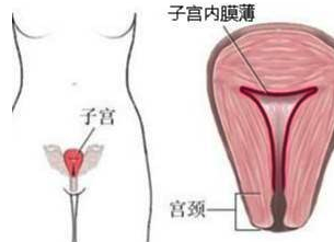 结婚5年怀孕2次都没成功，我的孩子去哪了？