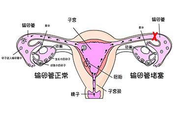 u=2295163814,2278914642&fm=27&gp=0.jpg